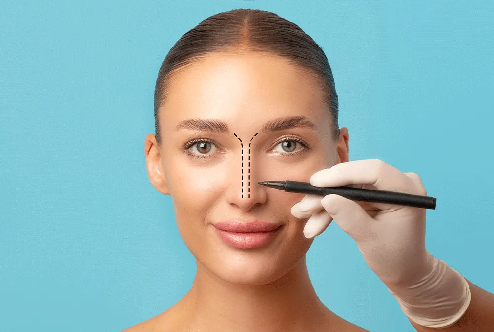 What You Need to Know About Rhinoplasty