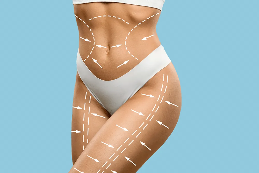 Body Contouring surgery